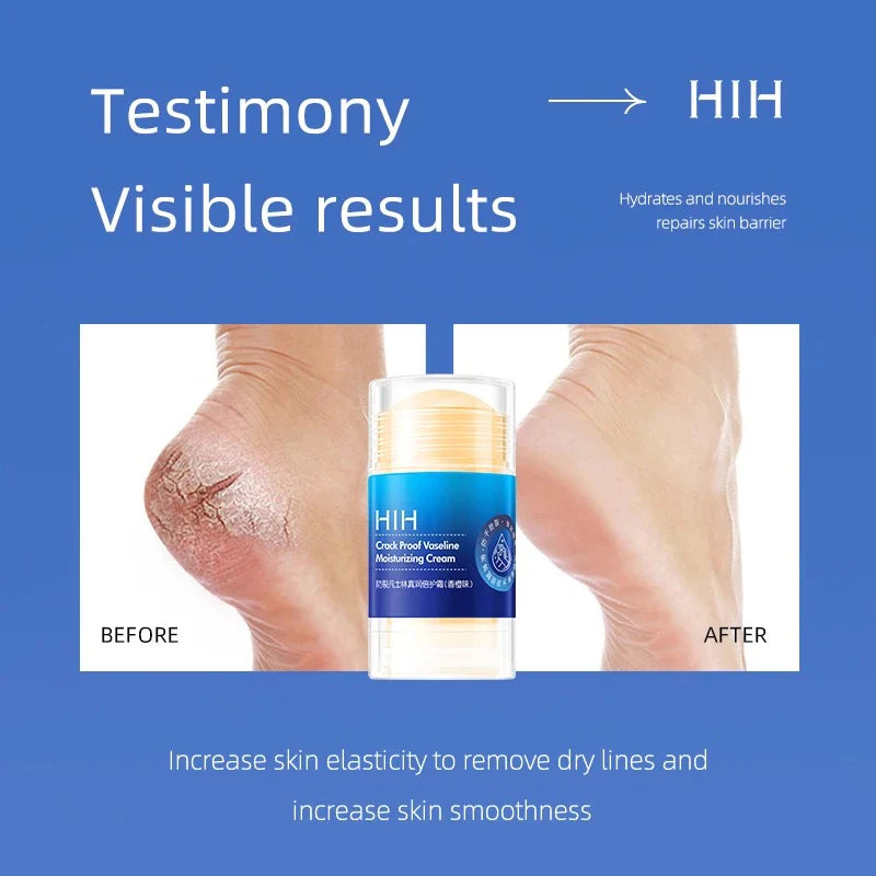 Pachet Promo 2+1 Cadou! Cremă Hidratantă Vaseline Speciala HIH, Hidratare intensă Cu vitamina E și ceară de albine, stick/roll-on, 35g, Pentru mâini, coate și picioare